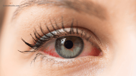 Krijg je rode ogen van CBD olie?