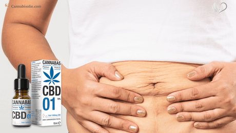 CBD Olie en Huidproducten voor Striae (Zwangerschapsstriemen)