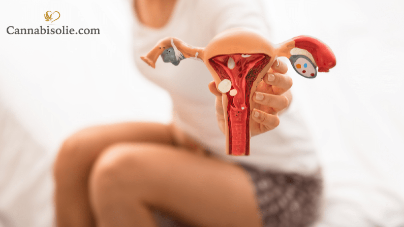 endometriozis cbd yağı